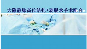 大隐静脉曲张高位结扎及剥脱手术配合
