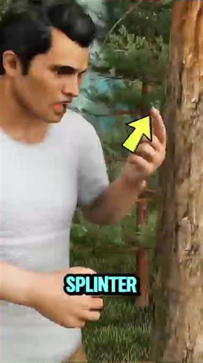 #creatorsearchinsights Remove a Splinter Instantly With THIS Simple Trick (No Pain, No Tweezers#neil #foryoupage #fyp #viral