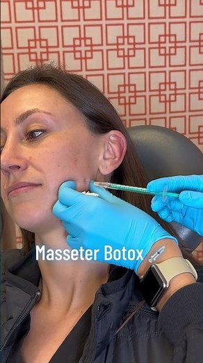 Masseter Botox Revolutionizes Facial Slimming!