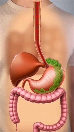 A hyper-real 8K cinematic breakdown of human digestion shown through a transparent-skin anatomical overlay. A male subject holds a halved avocado while an ultra-detailed internal animation tracks the food from mouth to stomach to intestines. Every organ is rendered with medical precision — peristalsis, enzymes, tissue texture, vascular detail, and real-time breakdown of nutrients. Subtle body motion, synced swallowing, internal ASMR sounds, and clean studio lighting turn this into a medically ac