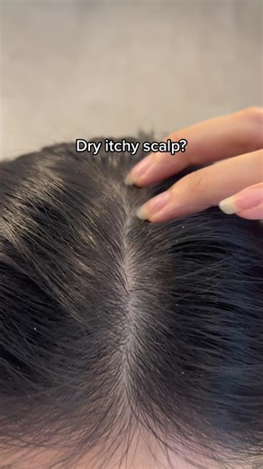 Our scalp massager works alongside your shampoo to help gently brush and exfoliate away flaky dry dandruff, oils, and built up hair products. Your hair will feel so much lighter, fresh and clean! More info in our bio 🤍🫶🏻✨ #viral #tiktok #dandruff #hacks #showertips #haircaretips #scalpscrubber #scalpmassager #scalpcare #scalp #greasyhair #oilyhair #hair #shower #flakyscalp #nz #akl