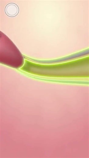 development of fallopian tubes 3d animation #denzel #cuphead