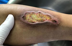 ¡Mucho cuidado! Esta enfermedad está acabando con la vida de los recién nacidos