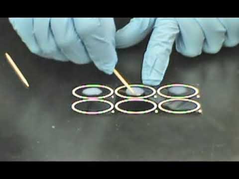 CRP Latex Agglutination