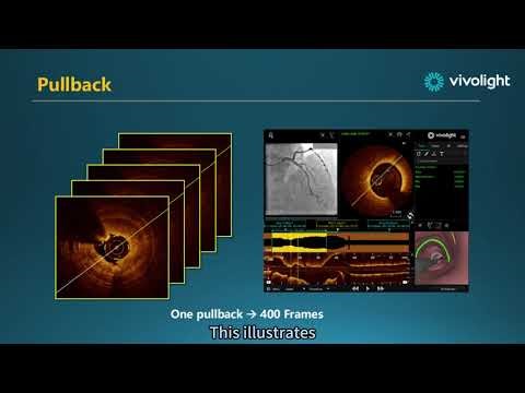OCT training course — about the content of OCT measurements
