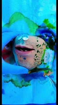 Mr Kiwi rushed to Emergency Surgery after car accident! #DiscountDentist Ep201 #FruitSurgery #Shorts