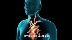 很多人都有过心律失常，专业医生是怎么解决的？心脏射频消融术3D动画演示