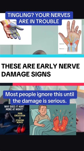 ⚠️ NERVE DAMAGE SIGNS YOU SHOULD NEVER IGNORE Not all nerve damage feels the same Tingling. Burning. Numbness. If this sounds familiar, your nerves may be struggling — and most people miss it early. COMMON SIGNS & SYMPTOMS • Pins and needles in hands or feet • Burning or electric-shock pain • Numbness or loss of sensation • Muscle weakness or dropping things • Poor balance or coordination • Sensitivity to touch or temperature TYPES OF NERVE DAMAGE • Peripheral – affects hands, feet, arms, legs •