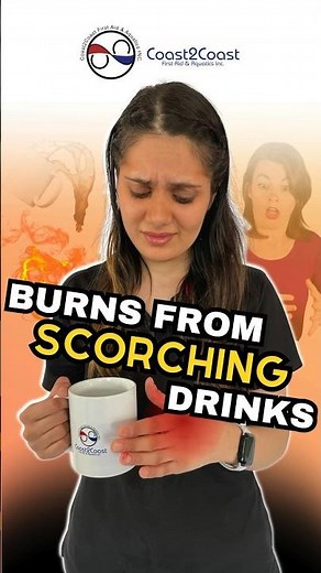 Quickly heal thermal burns from coffee or tea ☕️ #burns