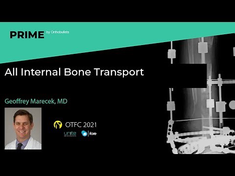 All Internal Bone Transport - Geoffrey Marecek, MD