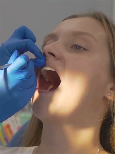 تقويم الأسنان في مرحلة الأسنان المختلطة: خطوات فعالة