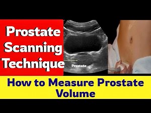 Prostate Ultrasound Scanning Technique || How to Measure Prostate Volume || By Dr. Abdullah Rajpoot