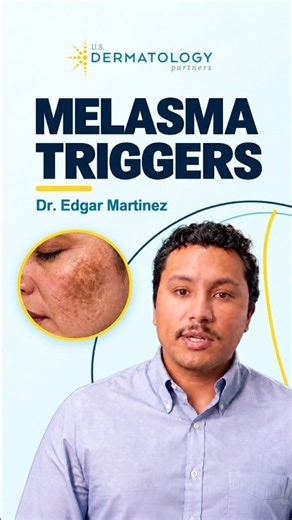 Why Your Melasma Won’t Go Away (And What Can Help)