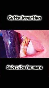 Gutta Insertion #Shorts #youtubeshorts