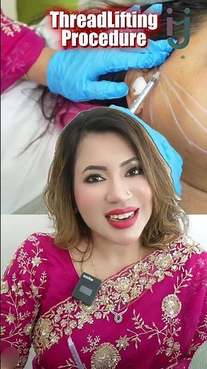 Thread Lift Procedure