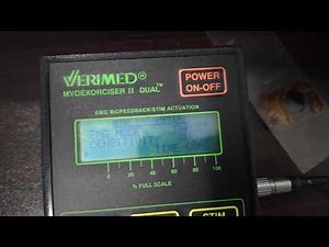 Surface EMG demonstration