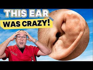 This EAR was CRAZY! (I couldn't believe it!)