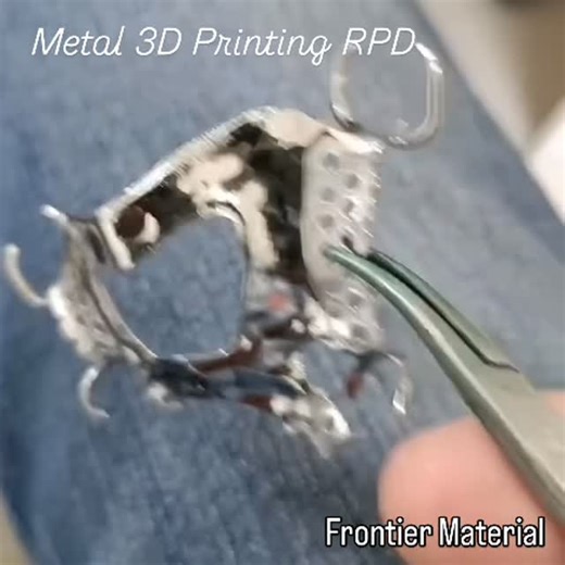 Metal Powder_Frontier Material on Instagram: "Metal 3D Printing RPD #Frontiermaterial #alloypowder #cobaltchrome #nickelchrome #dental3dprinting"