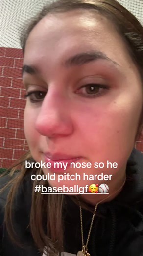 Understanding Concussions in Baseball Players