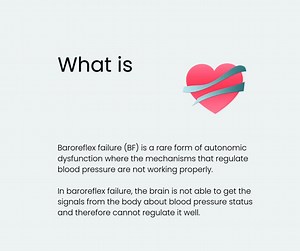 Baroreflex failure (BF) is a rare form of autonomic dysfunction where the baroreflex mechanisms are not working properly. Baroreflexes are important for the regulation of blood pressure. When activated, the baroreflex sends electrical signals to the brain where it is combined with other input from the body. When blood pressure is too high, the baroreflex activates the parasympathetic nervous system and inactivates the sympathetic nervous system. The parasympathetic nervous system activation will