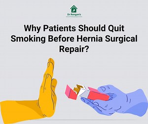 Quit smoking before hernia surgery: What patients need to know?