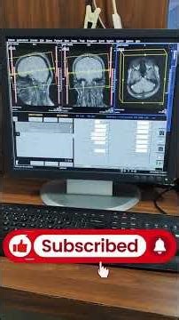 MRI BRAIN AXIAL VIEW PLANNING 💯✅ # ALL ROUNDER TECHNICIAN #