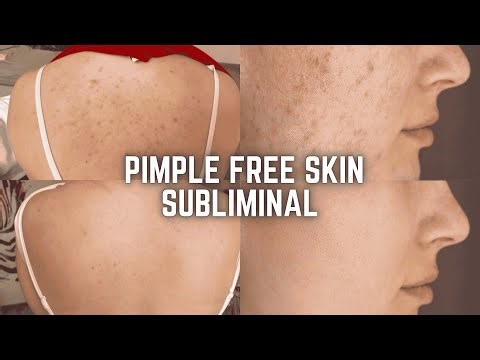 ✨CLEAR SKIN IN 1 HOUR✨ Fastest Pimple-Free Subliminal | Instant Acne Removal & Glowing Face