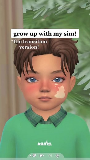 Sims 4 Vitiligo Skin Detail Transformation | Sim Growing Up Journey