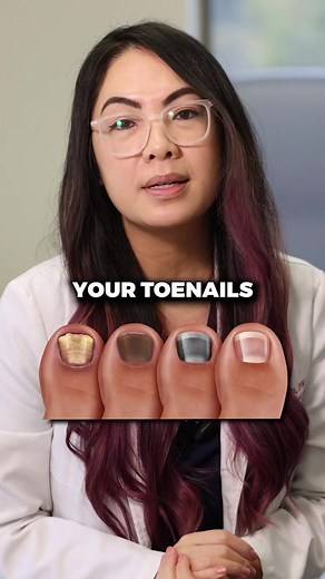 What to Do If Your Toenails Are Discolored