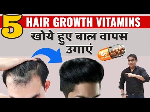 Top 5 Vitamins & Nutrients For Instant HAIR GROWTH | Stop Hair Loss And Regrow Hair Naturally.