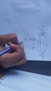 From the field pattern shown in figure, identify the correct st... | Filo