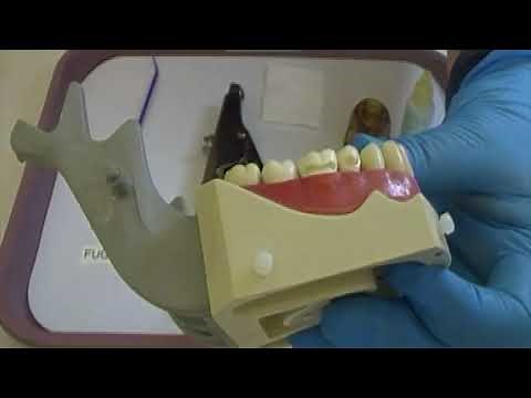 Glass Ionomer Fuji IX