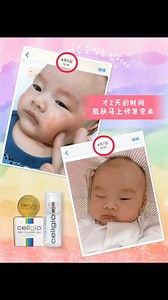 1.4K views · 13 reactions | 妈妈帮他使用 Cellglò 美白皂和 Cream21 才两天时间皮肤￼￼￼￼马上修护完美 Cellglò 产品不分男女老幼孕妇都可以使用￼ #Cellglo美白皂 #CellgloCream21 | NEO Secret Recipe 小妹私房菜 | Facebook