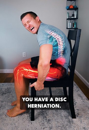 Disc Herniation Test and Relief Techniques