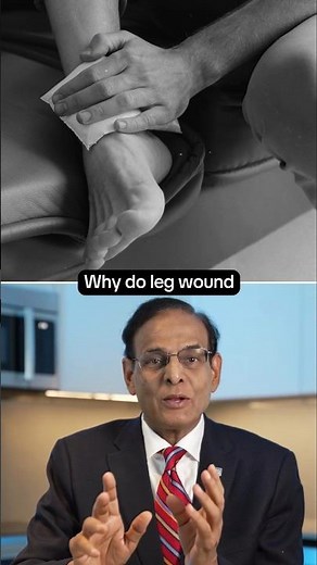 Why Leg Wounds Heal Slowly | Poor Circulation, Diabetes & Slow Healing Explained