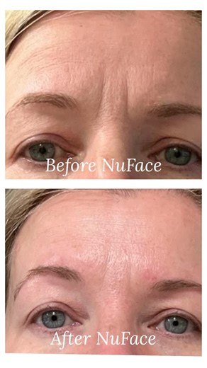 Deanna Deal/Spa/Facials/Holistic/ Halifax NS | NuFace Trinity Pro + is the perfect at home treatment to maintain professional salon facial treatments. 5 minutes is all you need to... | Instagram