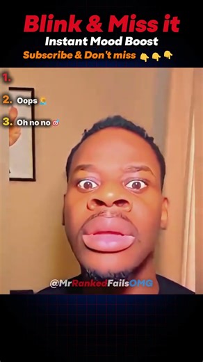 Crazy Fail Moments 😂 Try Not to Laugh #shorts