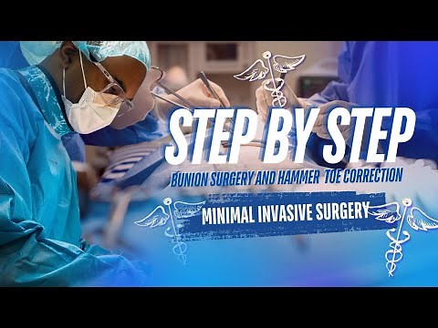 Step by Step: Minimally Invasive Bunion & Hammer Toe Surgery | Full Length Guide! 🔍