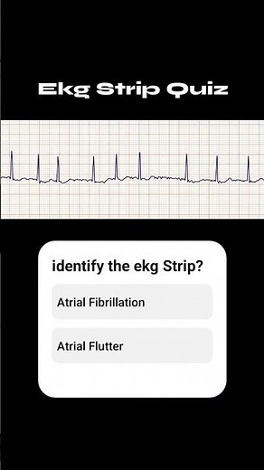EKG Quiz Time! Can you spot the rhythm?