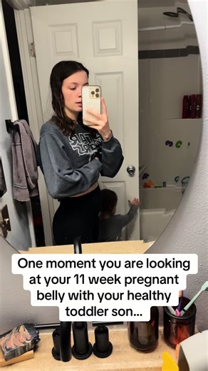 March 2024, Archie got a traumatic brain injury while in the care of a babysitter (also a trusted friend at the time). Unfortunately we don’t know what happened to offically cause his injury. Because the case is still open we will not be giving her information and we will not tell you what we suspect to have happened. What we will tell you is that with the severity of his injury and how he was found it’s not likely that’s how it happened. She’s said to have found him unconscious faced down next 