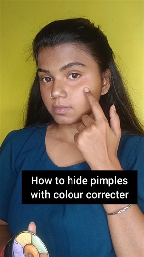 How to Cover Up a Pimple in 10 Seconds 😳 | Flawless Makeup Trick #shortsfeed #pimple #acne #makeup