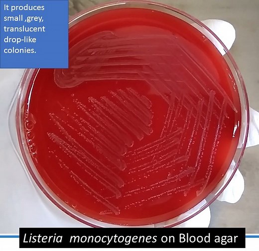 Listeria on blood agar: Introduction, Morphology, Culture characteristics