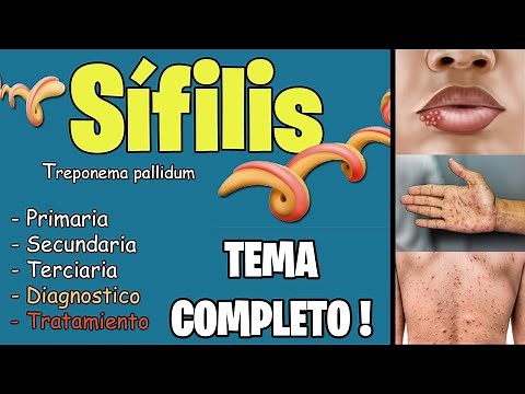 SYPHILIS: PATHOGENESIS, symptoms, TREATMENT | Treponema Pallidum | Best Explained ✅