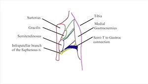 Hamstring Graft Harvest