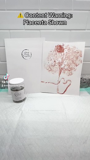 2.4K views · 29 reactions | As long as placenta is stored correctly…...