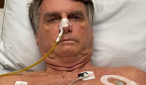 Bolsonaro faz tomografia depois de piora clínica