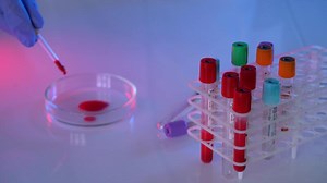 Laboratory blood tests.