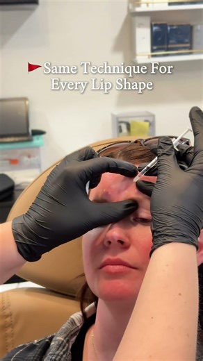 Not all injectors are created equal.