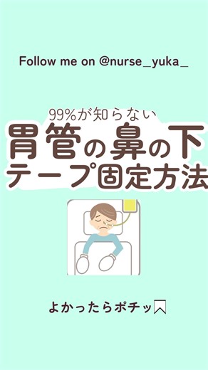 看護師ゆかちゃん|セカプリ on Instagram: "この貼り方だと剥がれるよ！と思った方は見て↓ この形は私がICUで勤務している時に貼っていたやり方になります。 ICUでは挿管患者さんがほとんどでEDチューブまたは、NGチューブが挿入れてました。その時のICUはアンカーファストを使用していたためアンカーファストが動くように工夫して貼ってました。そのため髭がある方でも貼れてました！ そのため、髭がある方や皮脂が多い人では取れやすいため、違うやり方をすることをおすすめします！ 違うやり方については初期の投稿を参考にしてみてください！ 見てくれてありがとうございます🌼 ゆかちゃん 臨床で活きる「知識」＠nurse_yuka_ そんな経験からみんなの「わからない」「早く知っておきたかった」「知って得する知識・根拠」を発信していきます😊 これまで急性期やリーダー，新人指導で得た情報をお届けします🚑 ※根拠ある正しい知識をお伝えするよう努めていますが本投稿に関する損失や損害については責任は負えませんのでご了承ください🙇‍♀️ #看護師の勉強垢 #新人看護師 #cvポート #看護師
