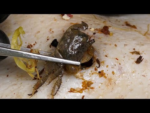 New S1 TLC DR LEE’S ULTIMATE ZITPOPPER with Tweezer とんでもなく嬉しいことが起きたので報告します 5180923